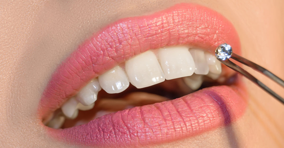 Tooth Jewellery